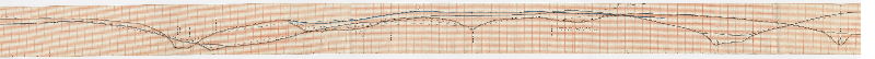 Plan, [No title. Long profile, probably of the Philadelphia and Olney Railway. Interesting topographical and infrastructure details: bridges, trestles, valley of Wingohocking Creek and other valleys. Shows what appear to be different proposed routes. Chatham St. is on the left end of plan, "Turnpike Olney" on right end. Only a small section of this very long plan was scanned.]